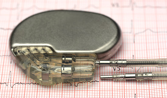 Leia mais sobre o artigo União terá que pagar cirurgia para homem que precisa de novo gerador de marcapasso (13/09/2022)