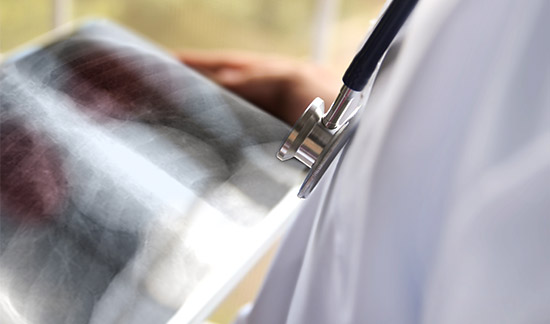 Leia mais sobre o artigo Idosa vai receber medicamento para tratar doença com risco de insuficiência respiratória aguda (17/01/2023)