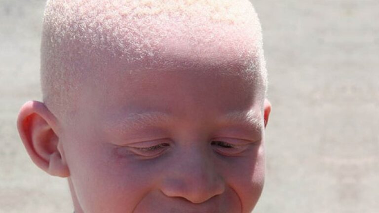 Leia mais sobre o artigo Indígena albino conquista na JFPR benefício assistencial (04/10/2024)