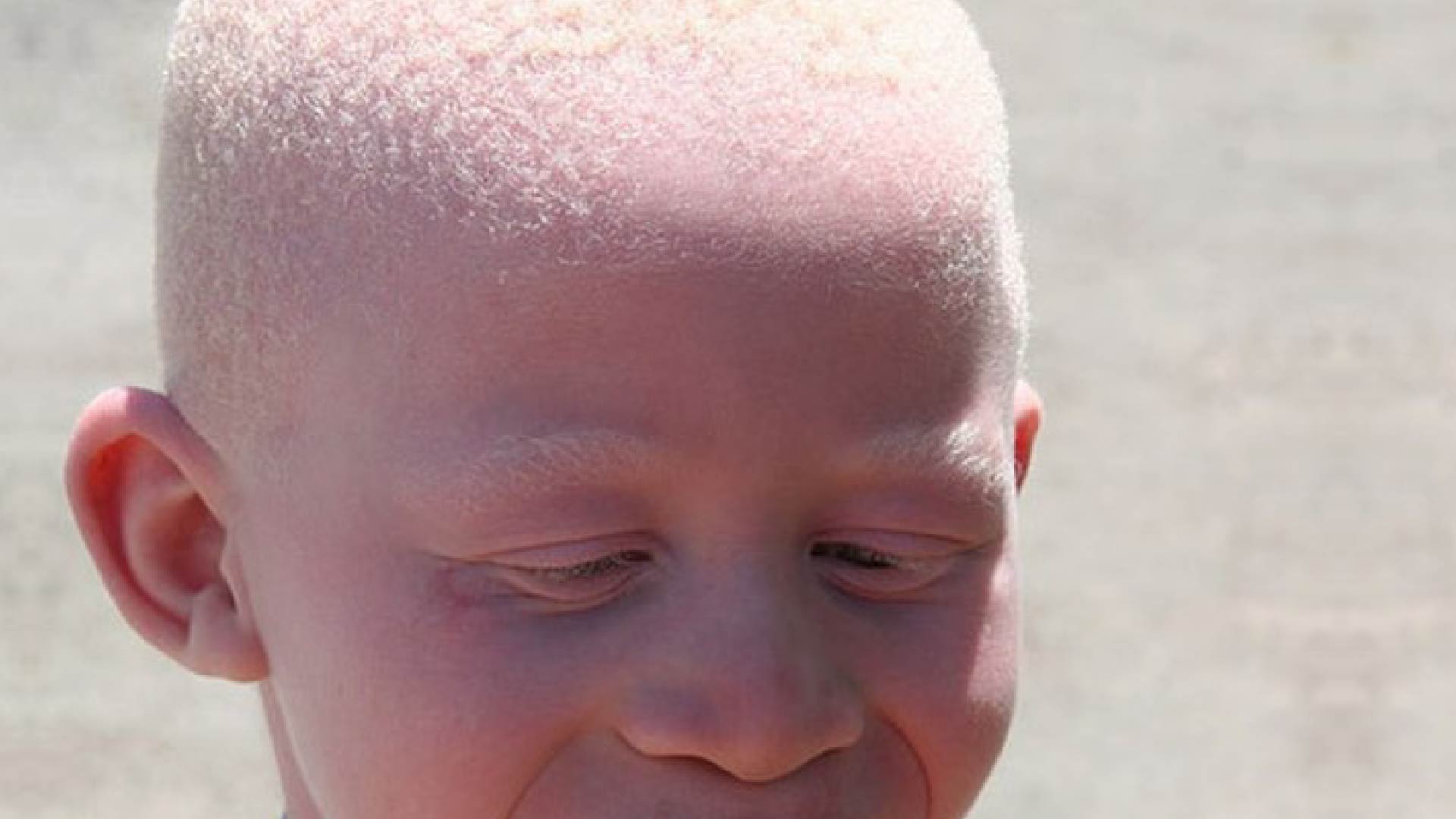 No momento, você está visualizando Indígena albino conquista na JFPR benefício assistencial (04/10/2024)